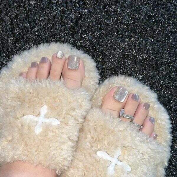 Wearing toenails - Image 2