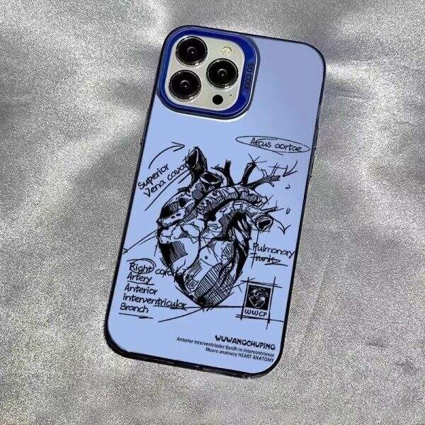 iPhone case - Image 4